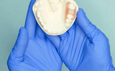 Krunica ili most kao rješenje