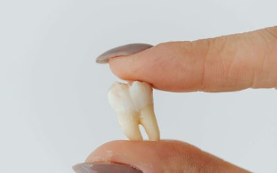 Njega rane i zubi nakon vađenja – što smijem, a što ne?