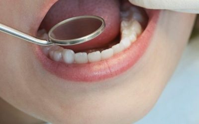 Back to School – stomatološki pregled za školarce i roditelje