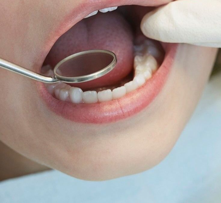 Stomatološki pregled za školarce i roditelje